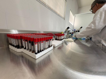 Procesan más de 100 muestras diarias contra brucelosis