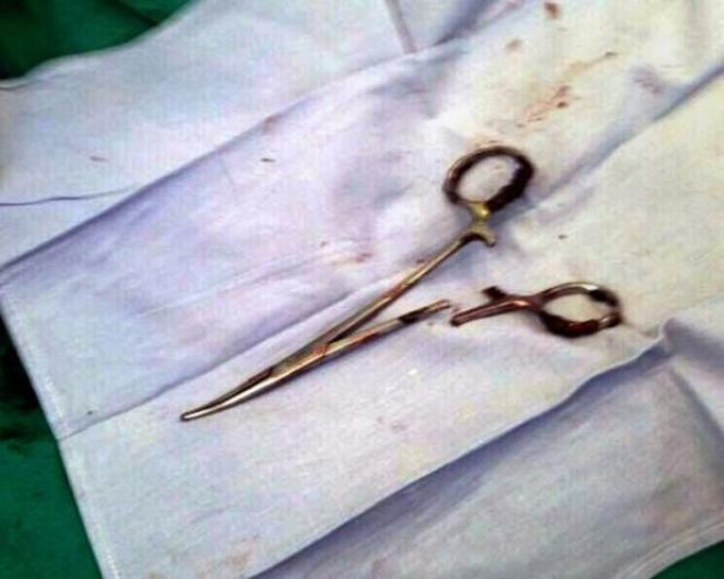 Extraen tijeras olvidadas de hace 18 años en el estómago de un hombre