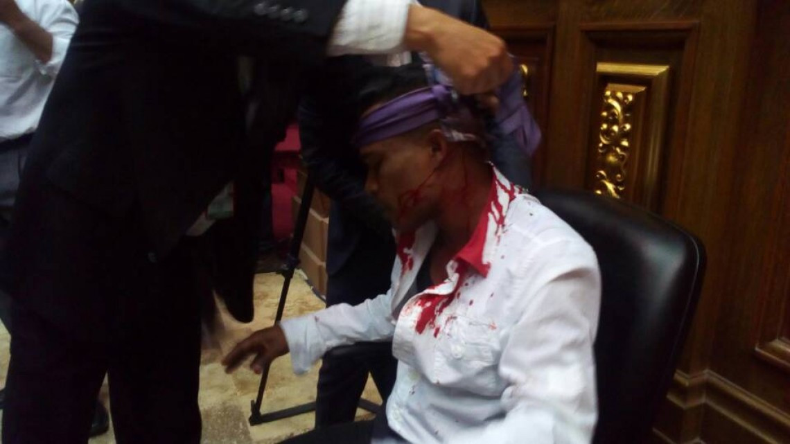 Se registran actos violentos en Congreso de Venezuela 