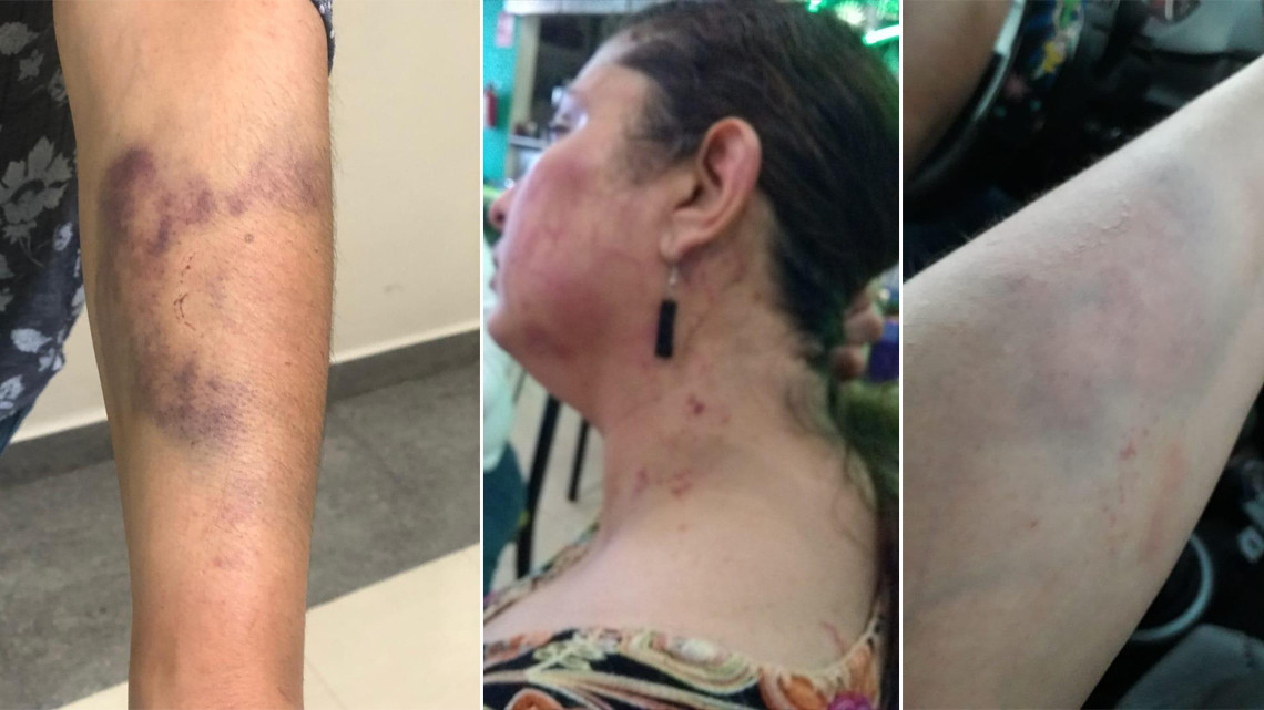 Golpean a defensora de los derechos humanos