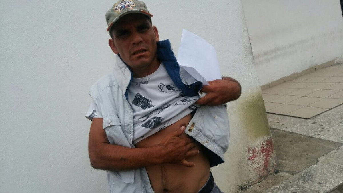 Denuncia abuso de poder a elementos de la PEA que lo agarraron a latigazos