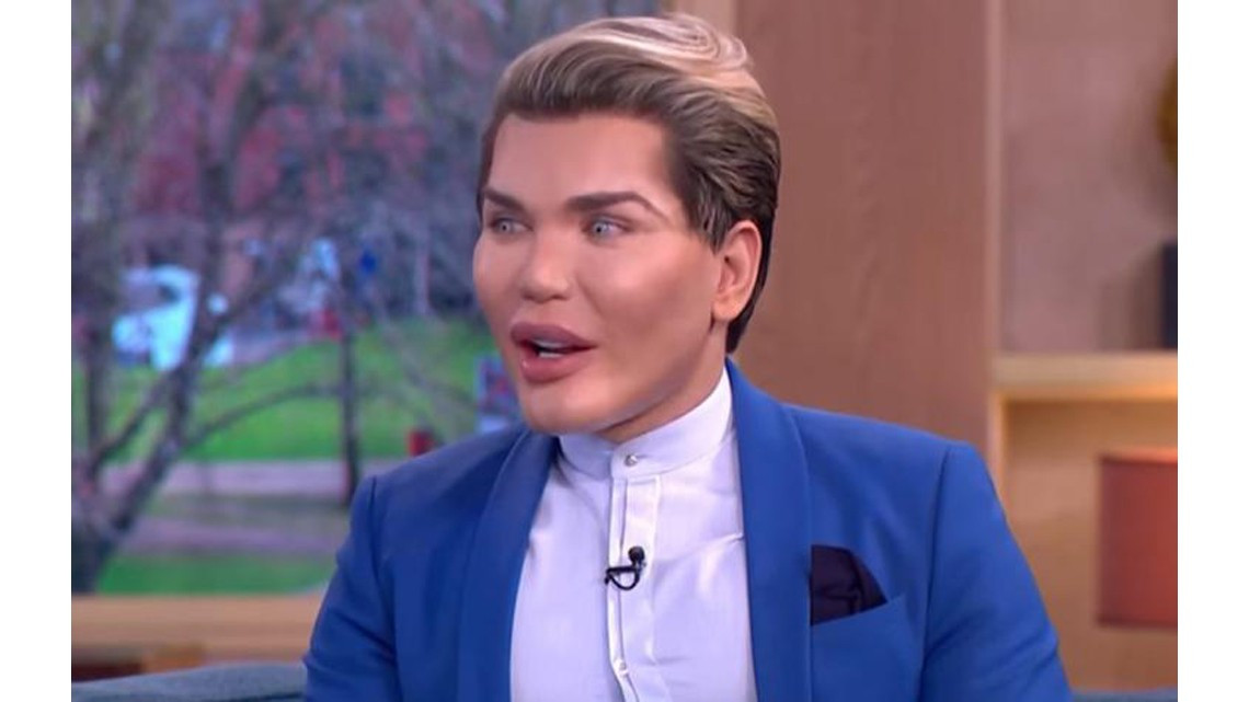 El "Ken humano" tiene complicaciones para respirar