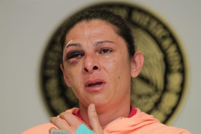 Culpan a Ana Guevara de golpear primero a su agresor