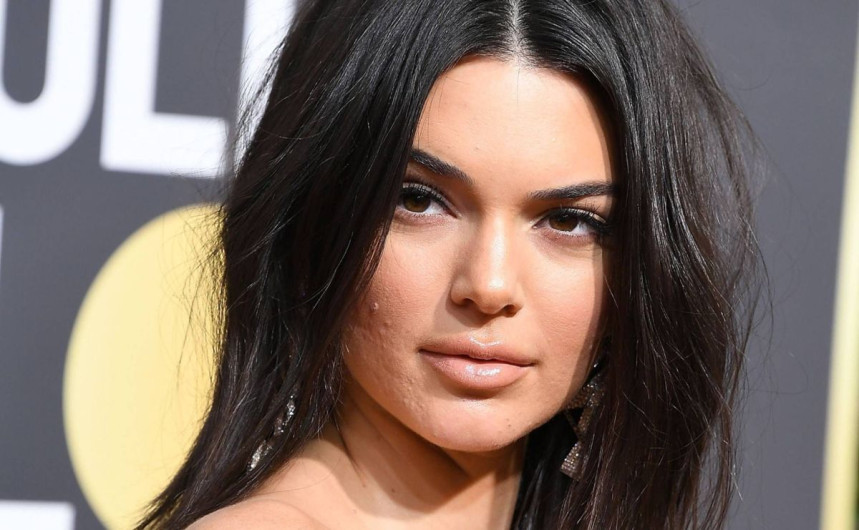Kendall Jenner responde a criticas sobre su acné